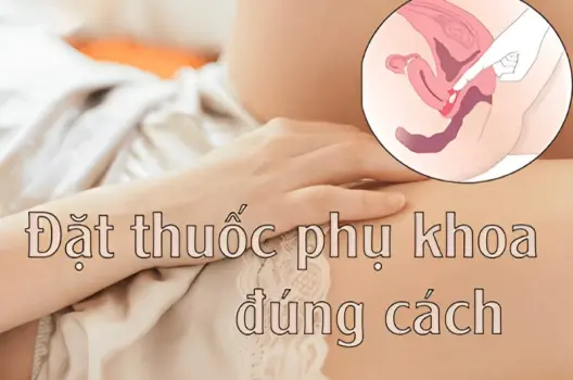 Hướng dẫn cách đặt thuốc phụ khoa tại nhà