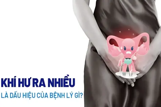 Khí hư ra nhiều có bị sao không bạn cần biết điều này