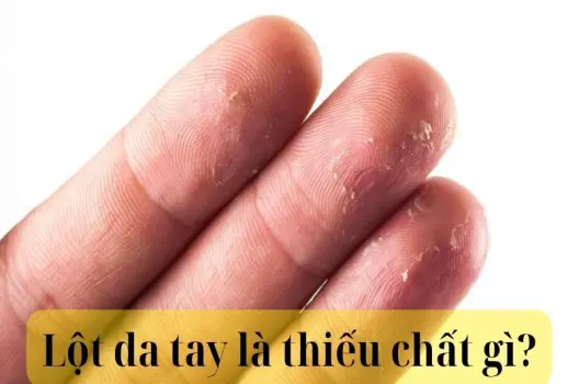 Lột da tay là thiếu chất gì? Cách nhận biết và xử lý