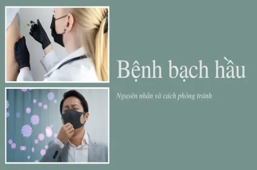 Bạch hầu là bệnh như thế nào? Hiểu rõ để phòng tránh hiệu quả
