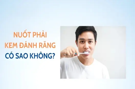 Nuốt kem đánh răng có bị sao không và cách xử lý