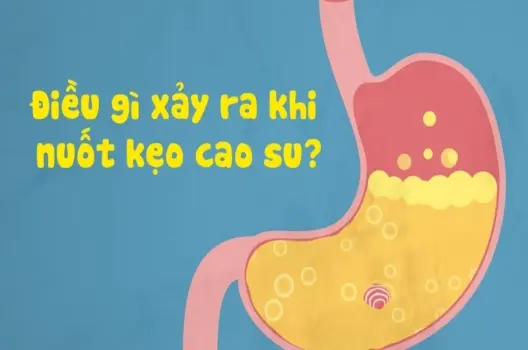 Nuốt singum có bị sao không và cách xử lý kịp thời