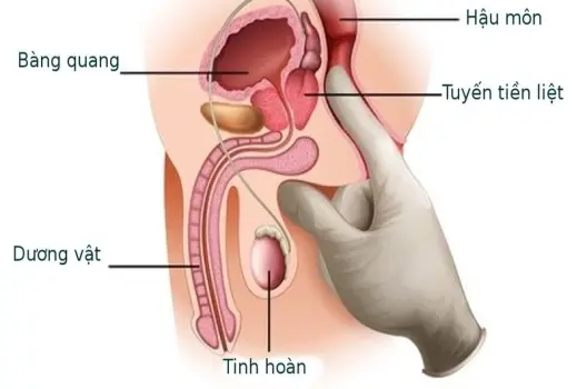 Quan hệ cửa sau có bị sao không và ảnh hưởng sức khỏe