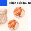 Trải nghiệm nhận biết dấu hiệu đau ruột thừa chuẩn xác nhất