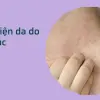 Cách nhận biết gan bị nhiễm độc sớm để bảo vệ cơ thể