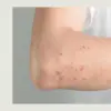 Dấu hiệu nhiễm giun sán và cách nhận biết và khi nào cần tẩy