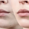 Bí quyết làm môi hết thâm hiệu quả nhanh chóng tại nhà