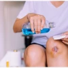 Cách làm bong vảy vết thương nhanh chóng và an toàn