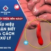 Đau ruột thừa như thế nào? Dấu hiệu nhận biết và cách xử lý sớm