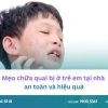 Mẹo chữa quai bị ở trẻ em an toàn và hiệu quả tại nhà