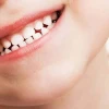 Răng Sữa Là Gì? Tất Tần Tật Thông Tin Cần Biết Cho Bé