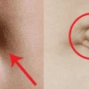 Rốn Đẹp Là Như Thế Nào? Ý Nghĩa và Tiêu Chuẩn Sắc Đẹp
