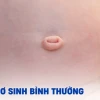 Rốn Trẻ Sơ Sinh: Dấu Hiệu Bình Thường và Khi Nào Cần Lo Lắng