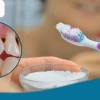 Tác hại của Baking Soda: Những nguy cơ tiềm ẩn bạn cần biết