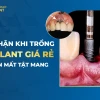 Tác hại của việc trồng răng implant và những lưu ý quan trọng