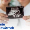 Thai 6 Tuần Tuổi: Sự Phát Triển Vượt Bậc Của Thai Nhi
