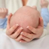 Thóp Trẻ Sơ Sinh Như Thế Nào Là Bình Thường? Dấu Hiệu Cần Lưu Ý