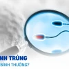 Tinh trùng là gì? Cấu tạo, chức năng và các yếu tố ảnh hưởng