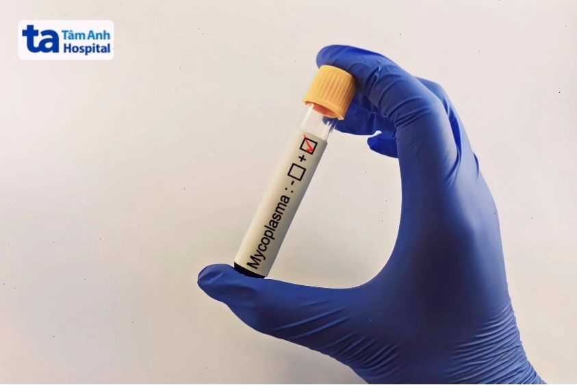 Bác sĩ chẩn đoán chứng nhiễm khuẩn Mycoplasma