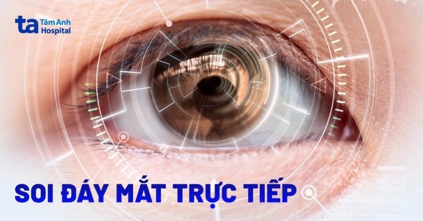 Bác sĩ đang thực hiện soi đáy mắt trực tiếp