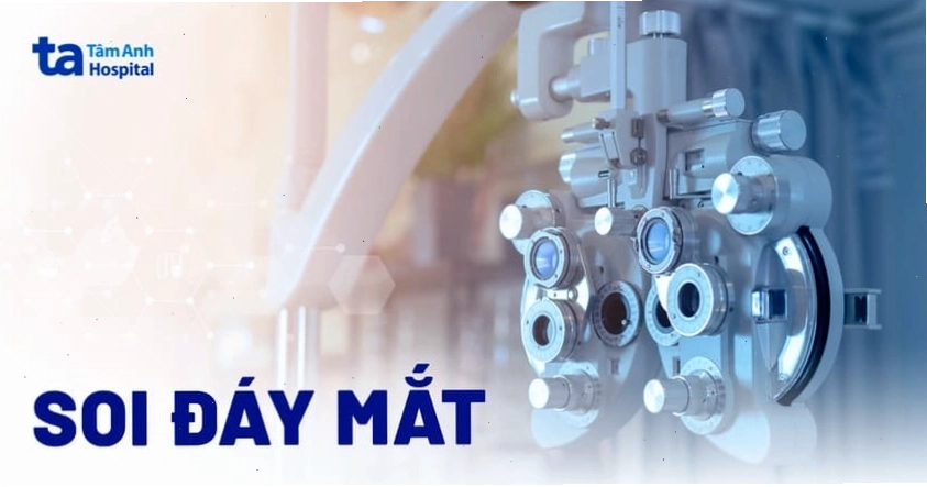 Bác sĩ phân tích kết quả soi đáy mắt