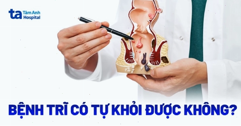 Bệnh trĩ có tự khỏi không