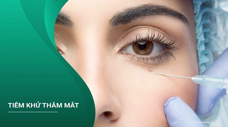 Các biện pháp thẩm mỹ giúp giảm quầng thâm mắt hiệu quả
