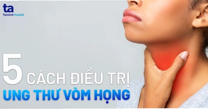 Các phương pháp điều trị ung thư vòm họng bao gồm xạ trị, hóa trị và liệu pháp miễn dịch.
