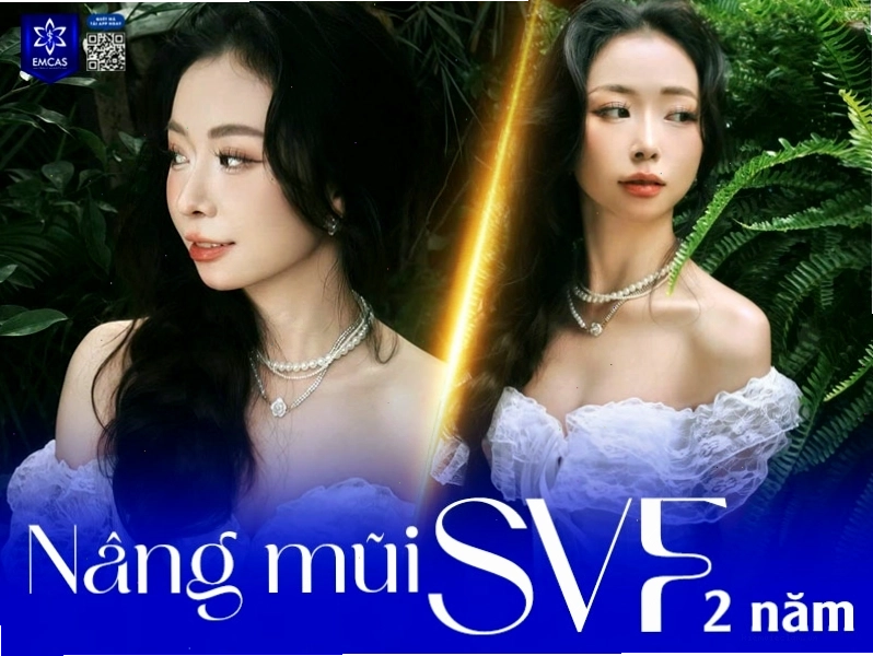 Các phương pháp thẩm mỹ để sở hữu dáng mũi cao