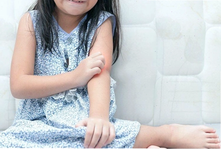 Cách trị nổi mề đay cho trẻ đúng và kịp thời đóng vai trò rất quan trọng