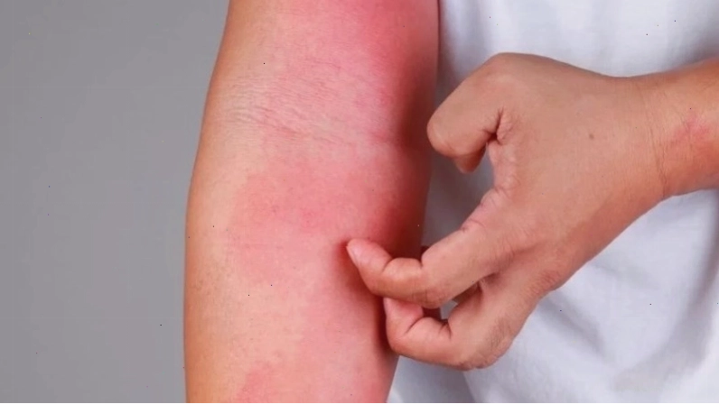 Cam thảo đất có thể gây dị ứng ở một số người