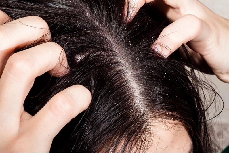 Cần cẩn trọng khi sử dụng bồ kết để tránh tác hại không mong muốn