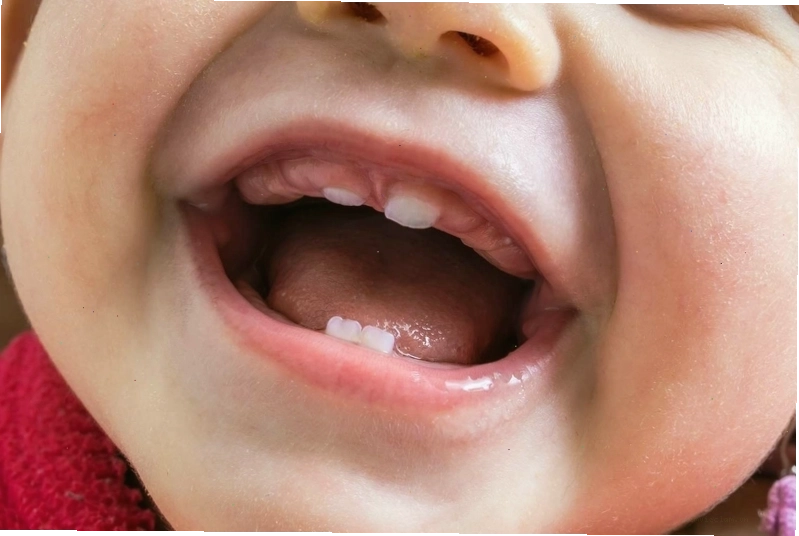 Cấu tạo răng sữa của trẻ nhỏ