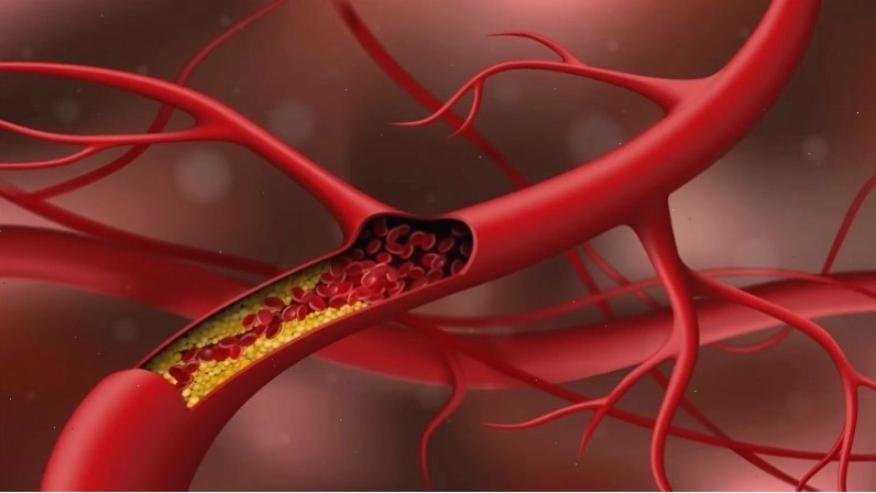 Cây xương khỉ có tác dụng cải thiện quá trình chuyển hóa lipid.