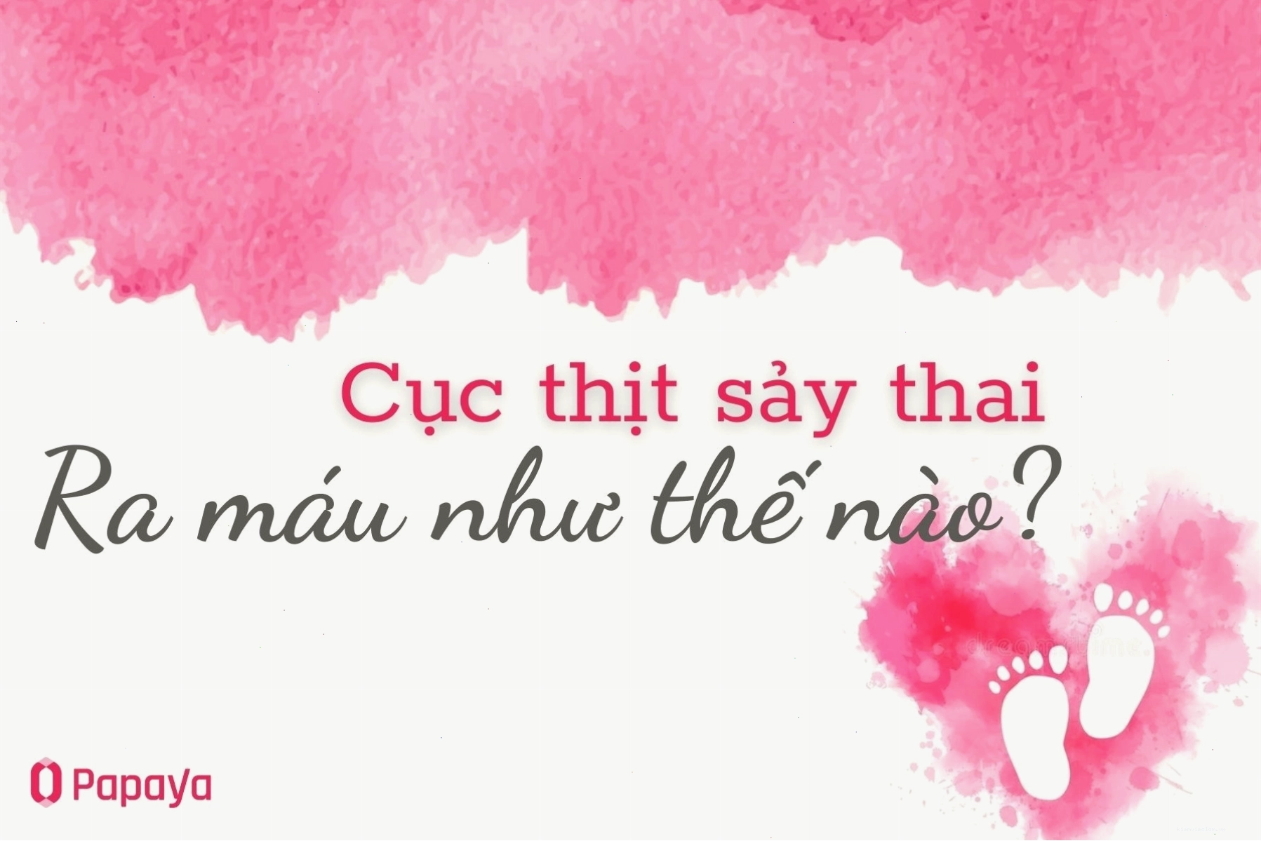 Cục thịt sảy thai ra máu như thế nào để nhận biết sớm