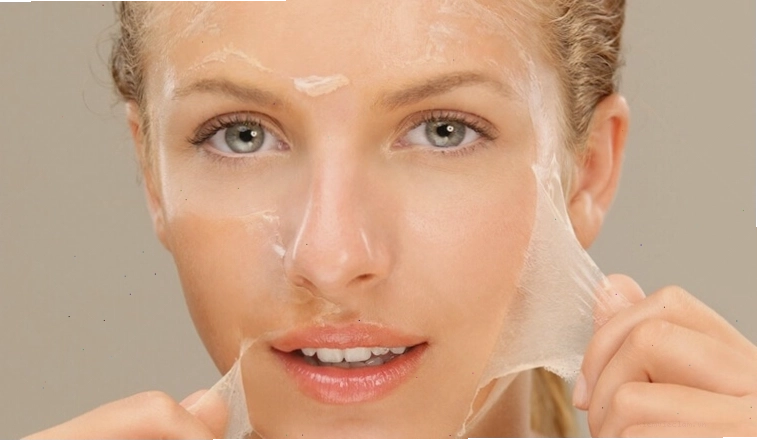 Da bị kích ứng, đỏ rát sau khi peel