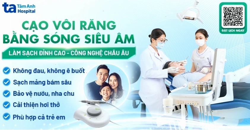 Dịch vụ cạo vôi răng giúp làm sạch mảng bám và giảm hôi miệng