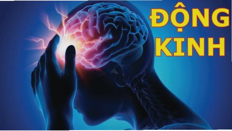 Động kinh là bệnh gì? Các dấu hiệu, triệu chứng, nguyên nhân và cách điều trị bệnh động kinh