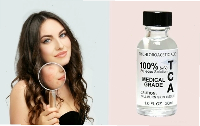 Giải thích TCA là gì và cơ chế tác động lên da