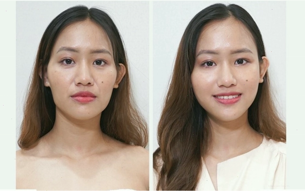 Gò má cao khiến gương mặt thanh thoát hơn