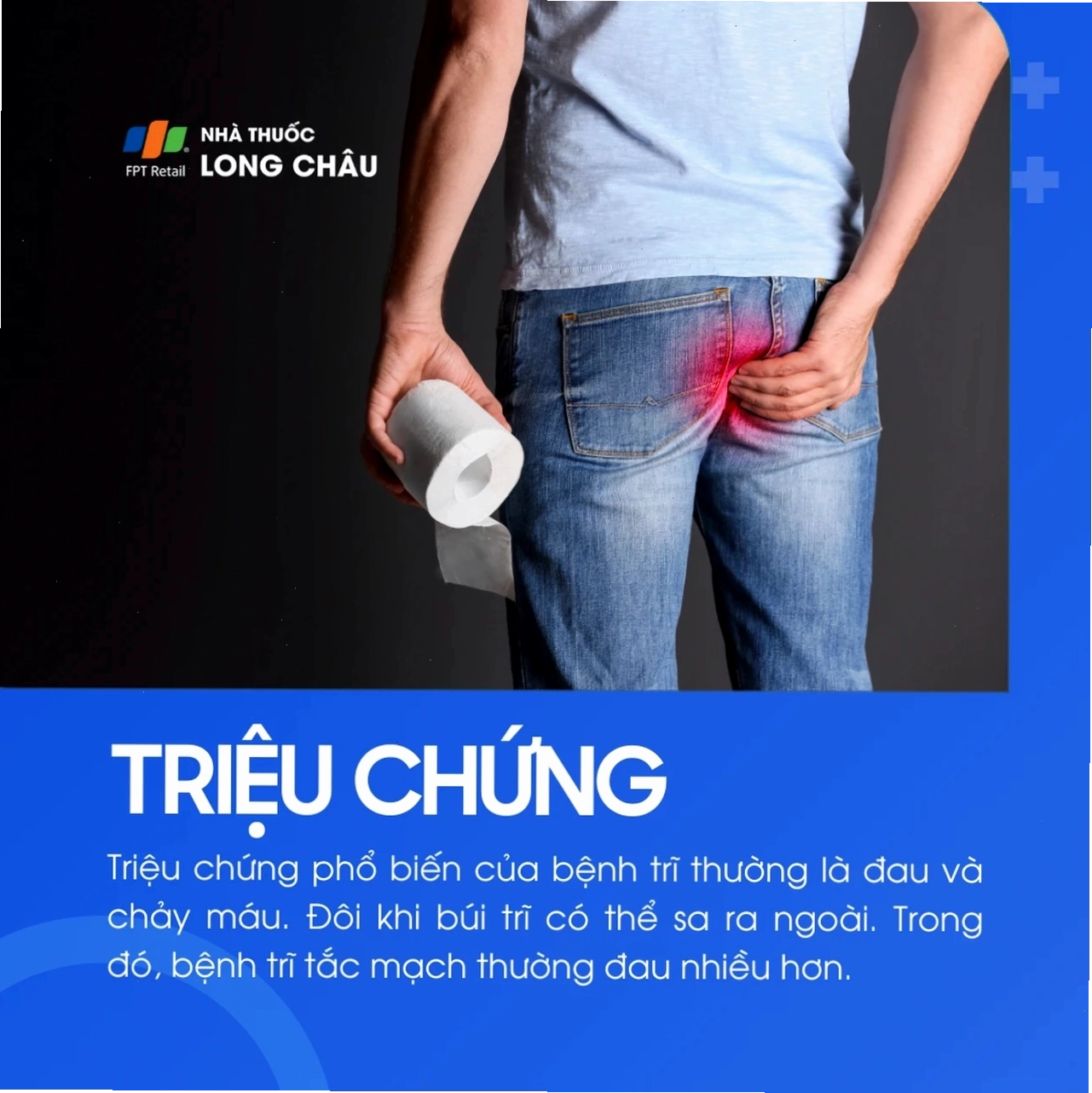 Hình ảnh minh họa bệnh trĩ ngoại