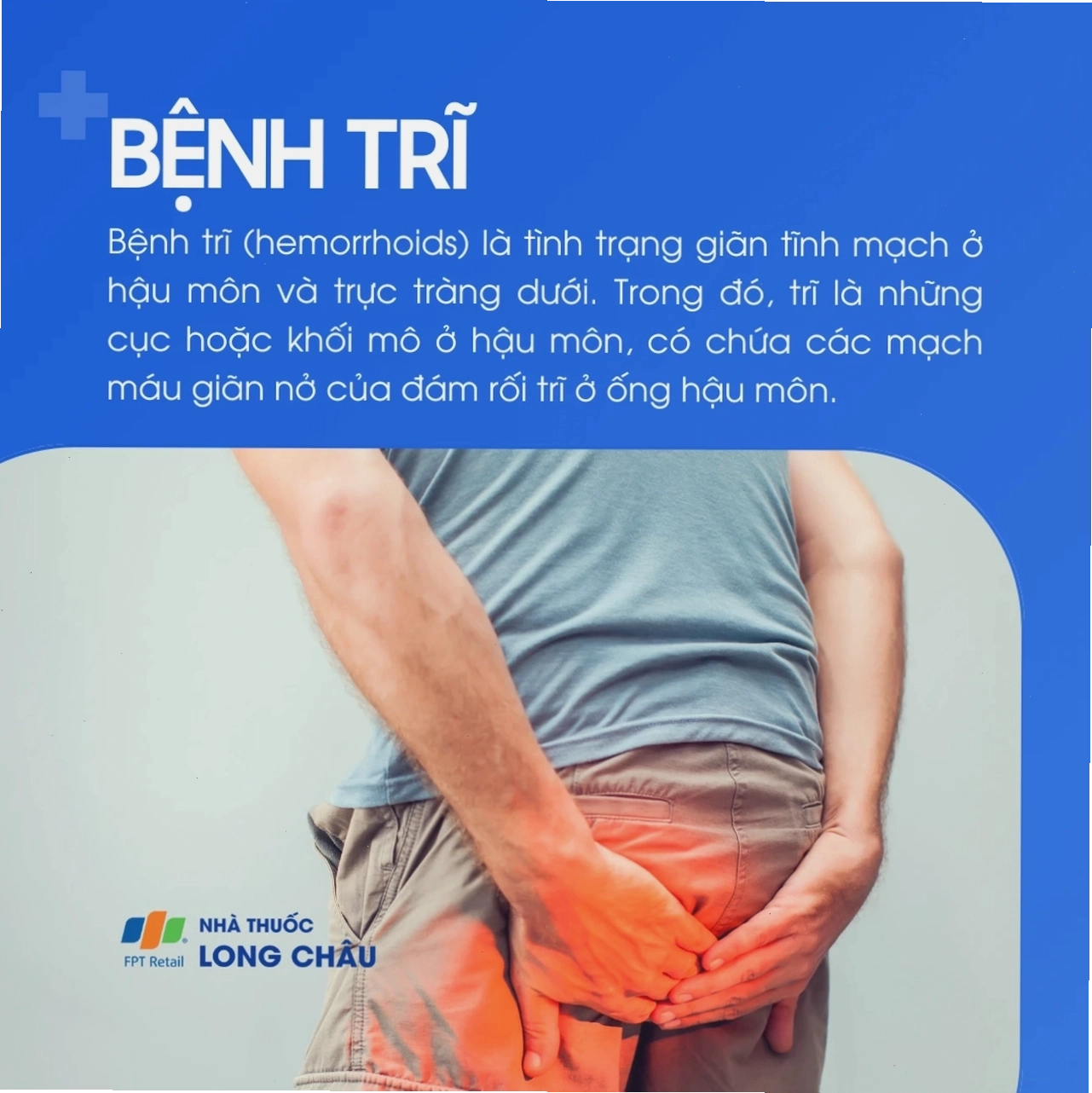 Hình ảnh minh họa bệnh trĩ nội