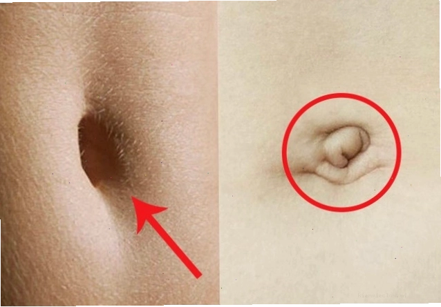 Hình ảnh minh họa các dáng rốn và ý nghĩa phong thủy