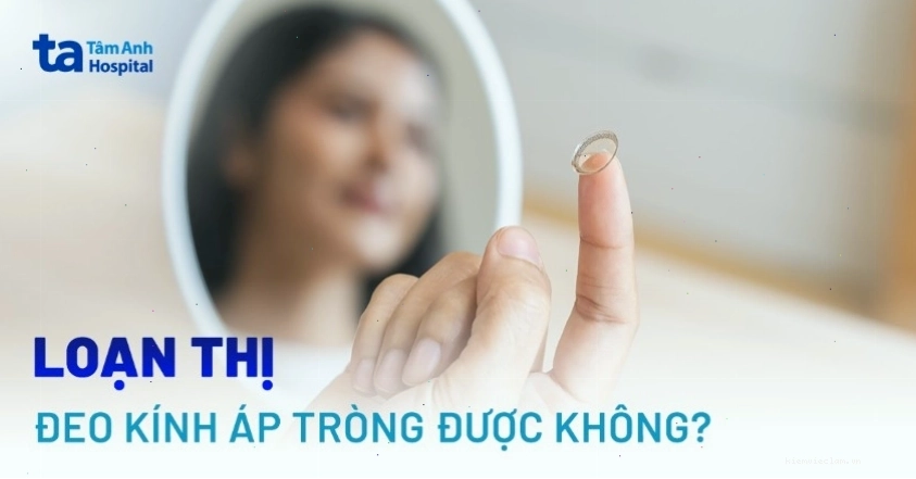 Hình ảnh minh họa người đeo kính áp tròng điều trị loạn thị