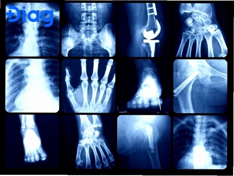 Hình ảnh phim chụp X-quang các bộ phận cơ thể người