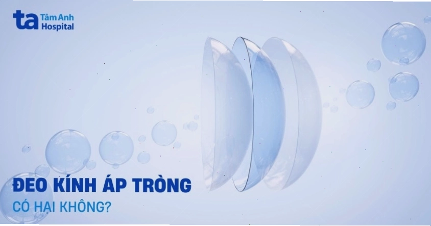Khô mắt là một trong những tác hại thường gặp khi đeo kính áp tròng, bao gồm cả Ortho-K