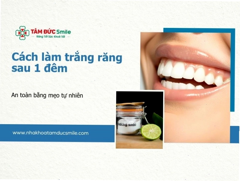 Lời khuyên từ nha sĩ về việc làm trắng răng tại nhà