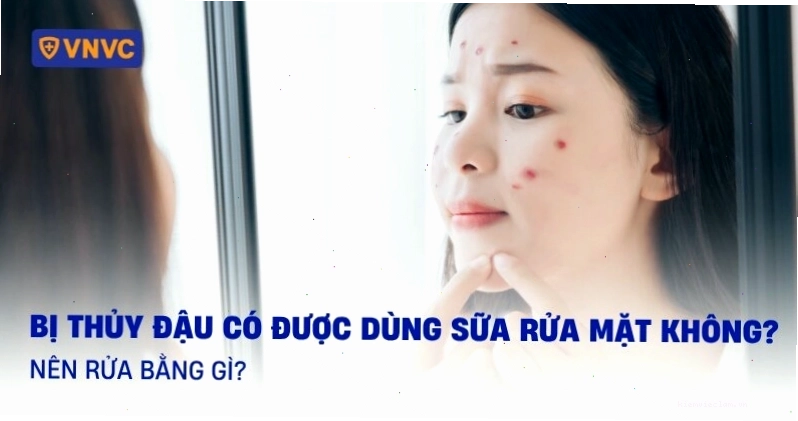 Lưu ý khi dùng sữa rửa mặt cho người bị thủy đậu