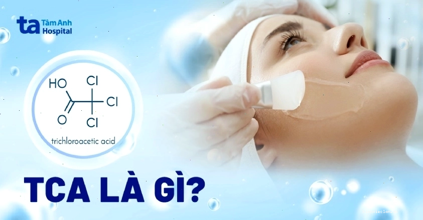 Lưu ý quan trọng khi sử dụng TCA để đảm bảo an toàn