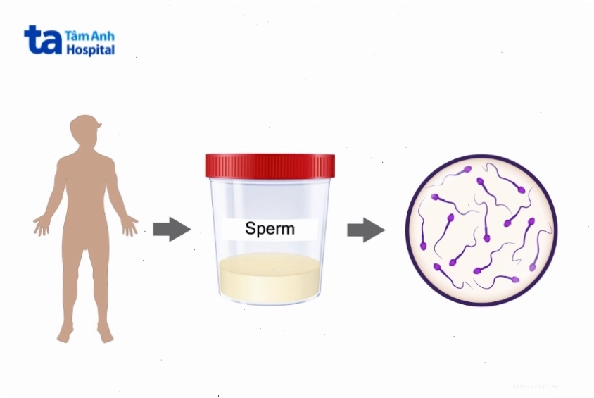 Mật độ tinh trùng giúp đánh giá khả năng sinh sản